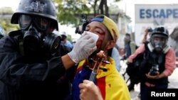 Wuilly Arteaga, a 23-year-old violinist, who was injured in the face, is helped during a rally against Venezuela's President Nicolas Maduro's government in Caracas, July 22, 2017.