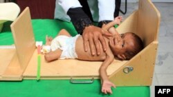 Seorang balita Yaman yang menderita malnutrisi dirawat di sebuah rumah sakit di provinsi Hajjah (foto: ilustrasi). 