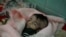 FILE - Hajar al-Faqeh, 4 months, who died at the malnutrition ward of al-Sabeen hospital, is seen at the hospital in Sana'a, Yemen, Nov. 15, 2018. 