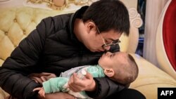 La foto tomada el 21 de octubre de 2021 muestra a Xu Wei sosteniendo a su hijo Xu Haoyang, diagnosticado con síndrome de Menkes, después de extraer orina de su vejiga para analizarla en un hospital, en su casa en Kunming, en la provincia de Yunnan, suroeste de China.