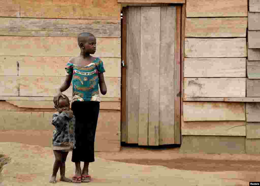 Mave Grace, anak perempuan usia 11 tahun, tangan kirinya dipotong oleh milisi bersenjata yang menyerbu desanya, tampak berdiri bersama adiknya (2 tahun) di kamp pengungsi Bunia, provinsi Ituri, Kongo timur. Milisi juga membunuh ibunya yang sedang hamil dan 3 saudara laki-lakinya.&nbsp;