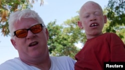 Un père et un enfant albinos.