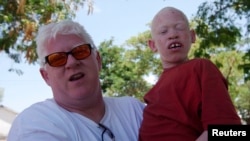 FILE - Canadian Peter Ash, who founded the lobbying group Under The Same Sun, holds an albino boy at a school in Tanzania’s Mwanza region in 2009. The International Federation of the Red Cross said albino killings had triggered 'a silent emergency.' 