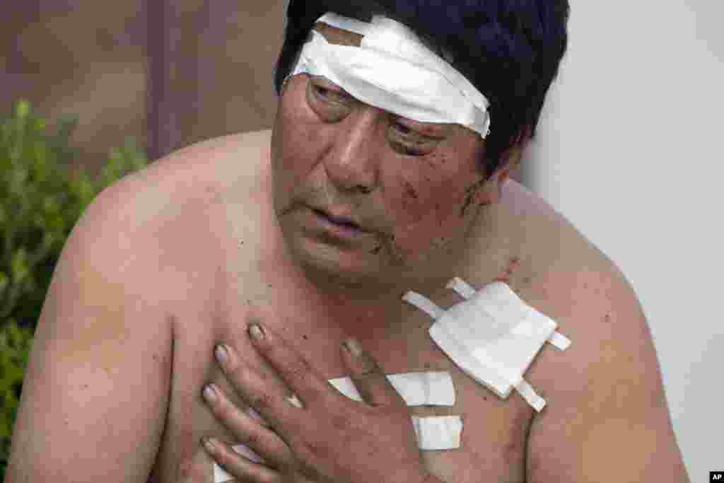Người bị thương trong vụ nổ ở Thiên Tân ngồi trước cửa một bệnh viện sau khi được băng bó các vết thương