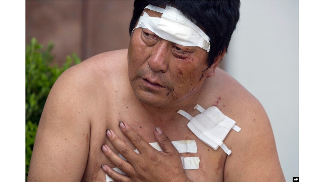 A man with his wounds bandaged rests outside a hospital receiving victims of an explosion in northeastern China's Tianjin municipality, Aug. 13, 2015.