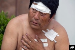 A man with his wounds bandaged rests outside a hospital receiving victims of an explosion in northeastern China's Tianjin municipality, Aug. 13, 2015.