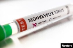 원숭이두창 바이러스 감염 검사에서 양성 판정된 시험관. (자료사진)