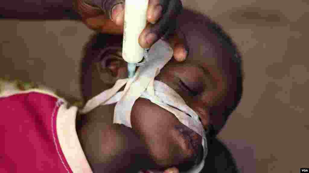 A malnourished child being fed at a clinic in Bossangoa, Nov. 9, 2013. (Hanna McNeish for VOA)