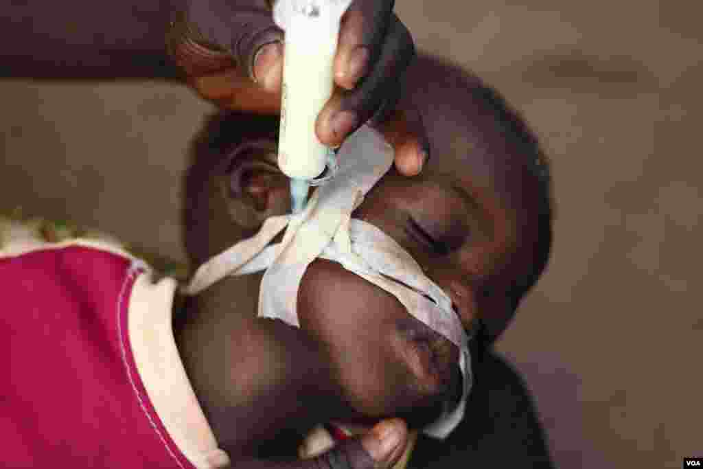 A malnourished child being fed at a clinic in Bossangoa, Nov. 9, 2013. (Hanna McNeish for VOA)