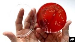 An employee displays MRSA bacteria strain - a drug-resistant 'superbug' - inside a petri dish containing agar jelly for bacterial culture in a microbiological laboratory.