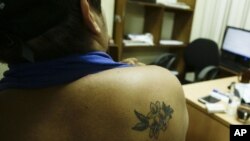 En esta foto del 24 de julio el 2018, un estudiante universitario que no quiso ser identificado por temor a represalias del gobierno muestra la quemadura de cigarrillo en su tatuaje de una sacuanjoche, la flor nacional de Nicaragua. 