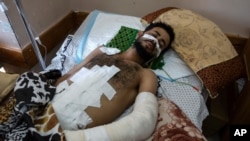 Ghassan Al-masri, 22, rests at the Shifa hospital in Gaza City, May 13, 2021, where he is being treated for injuries caused by a May 10 Israeli strike that hit a near his home in the town of Beit Hanoun.