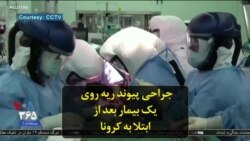 جراحی پیوند ریه روی یک بیمار بعد از ابتلا به کرونا