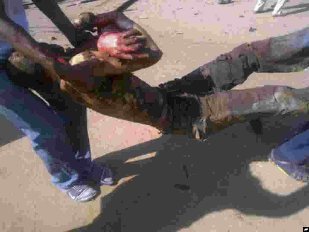 Rescuers carry a victim of a bomb explosion in Nigeria's northern city of Kaduna December 7, 2011. A powerful explosion struck the northern Nigerian city of Kaduna on Wednesday, killing at least six people, eyewitnesses said. It was not clear what caused