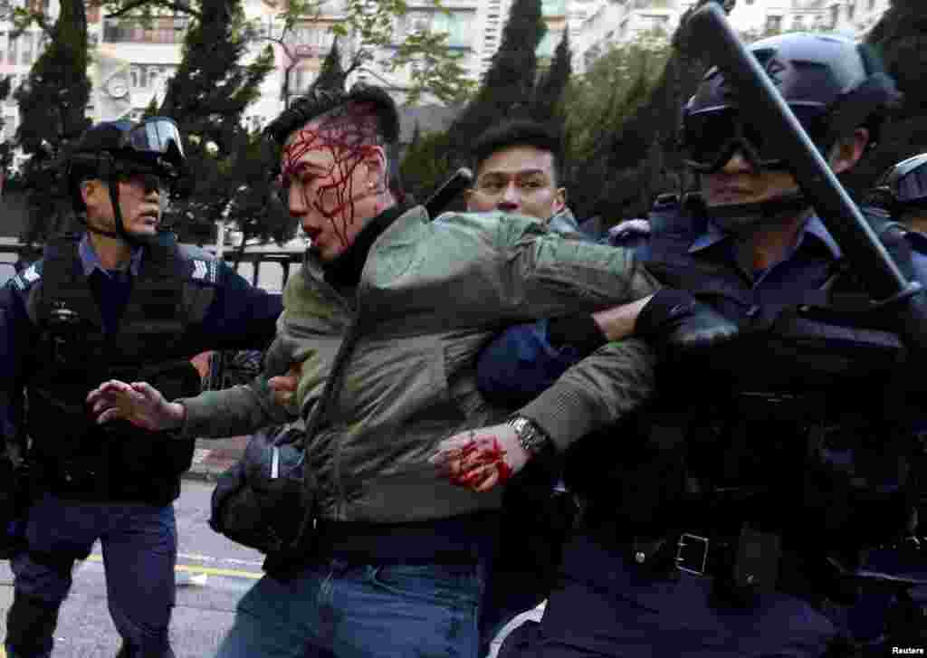 An unidentified injured man is escorted by riot police at Mongkok in Hong Kong. Riot police used batons and pepper spray to quell fights after authorities tried to move illegal street vendors from a working-class Hong Kong district, the worst street clashes since pro-democracy protests in late 2014. It is not known whether the injured man is a protester.