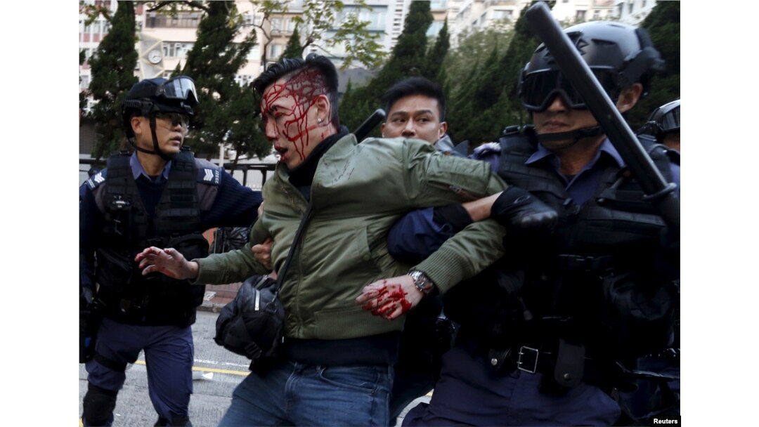 FILE - Riot police grip an unidentified injured man during protests in the Mongkok district of Hong Kong, Feb. 9, 2016.