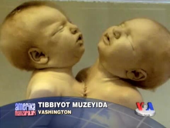 150 yil oldin ochilgan salomatlik va tibbiyot muzeyida/US Medical Museum