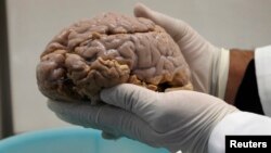 Los científicos han logrado reproducir exitosamente el Alzheimer en las células del cerebro humano en una caja de Petri