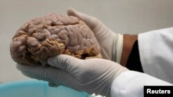 El uso de ultrasonidos prueba ser un nuevo método excitante en la lucha contra Alzheimer