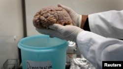 Un cerceau humain montré lors des recherches sur Alzheimer