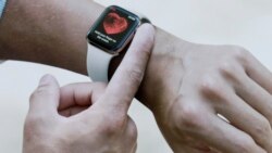 An image of the Apple Watch Series 4 is shown during a presentation at the Steve Jobs Theater during an event to announce new Apple products on Wednesday, Sept. 12, 2018, in Cupertino, Calif. (AP Photo/Marcio Jose Sanchez)