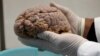 Científicos replican células del cerebro con Alzheimer