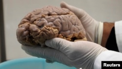 Los científicos han logrado reproducir exitosamente el Alzheimer en las células del cerebro humano en una caja de Petri