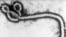 Picture of ebola virus