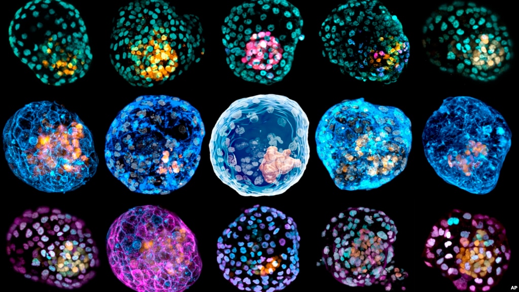 This undated combination of microscope images provided by Monash University in March 2021 shows different embryo-like structures stained to highlight different cell types. (Monash University via AP)