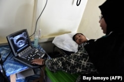 Seorang dokter melakukan USG pada seorang ibu yang sedang hamil di Klinik ASRI di Sukadana, Kalimantan Barat. (Foto: AFP/Bay Ismoyo)