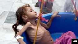FILE - In this Aug. 25, 2018, image made from video, a severely malnourished girl is weighed at the Aslam Health Center in Hajjah, Yemen.