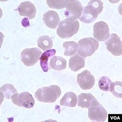 Parasit baru malaria yang mematikan, plasmodium vivax (tengah warna ungu), di antara sel-sel darah manusia (foto: dok).