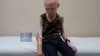 Attacked for Body Parts, Tanzanian Albino Children Get New Limbs in US