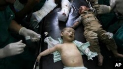 Wounded Palestinian children are treated in a hospital in Rafah in the southern Gaza Strip, Friday, Aug. 1, 2014. 
