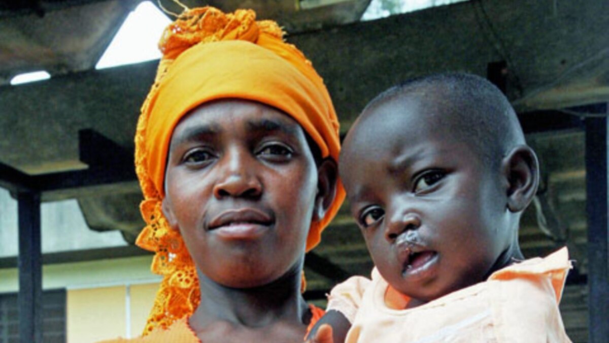 US Surgeons Bring Smiles to Zimbabweans With Cleft Lip