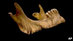 Para peneliti Universitas Leicester yakin bahwa kerangka yang digali Oktober tahun lalu ini adalah tulang belulang Raja Inggris Richard III yang meninggal tahun 1485 (foto: dok). 