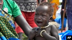 FILE - In this photo taken Dec. 10, 2017, a malnourished baby cries at the feeding center for children in Jiech, Ayod County, South Sudan. 