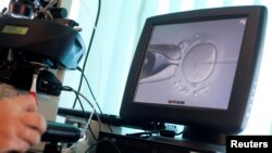 Seorang dokter sedang menyuntikan sperma ke dalam sebuah sel telur dalam pembuahan in-vitro (IVF) di klinik Novum, Warsawa, Polandia, 26 Oktober 2010. (Foto: Ilustrasi/Reuters)