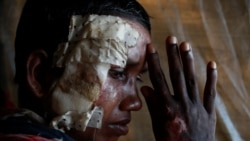 Rohingya refugee Momtaz Begum, 30, poses for a photograph at Balukhali refugee camp in Bangladesh October 19, 2017. REUTERS/Jorge Silva