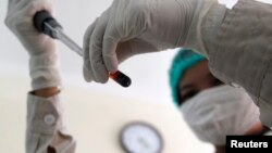 FILE - A health worker holds up a blood sample at the 09 Hospital in Hanoi.