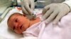 تولد نوزاد از بطن مادری که ماه‌ها پیش دچار سکته و مرگ مغزی شده بود