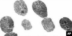 Fugitive William Keegan had all 10 fingers surgically altered in the 1990's to obliterate his fingerprints above the first joint.