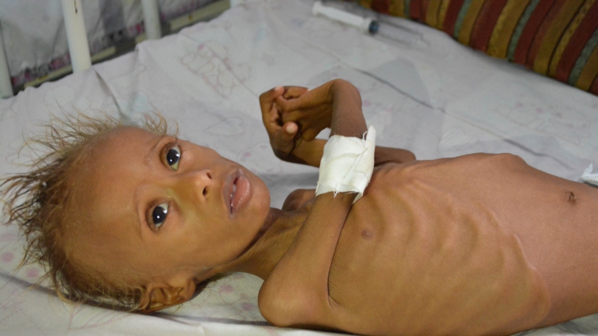 Who Cholera Death Toll In Yemen Rises To 1500