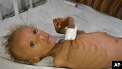 FILE - In this photo taken Sept. 9, 2016, Salem, 5, who suffers from malnutrition, lies on a bed at a hospital in the port city of Hodeidah, southwest of Sana'a, Yemen.