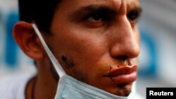 Un enfermero con el labio cosido toma parte en una protesta laboral en Caracas.
