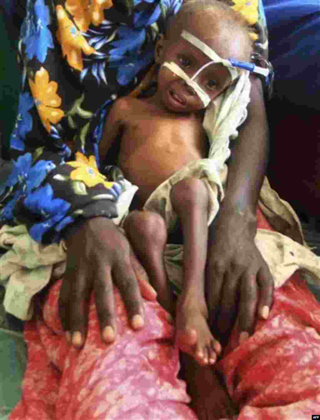 ARCHIV: Husein Momin, a 3-years-old malnourished child from southern Somalia sit on bed at Banadir hospital, Mogadishu, Somalia, after fleeing from southern Somalia (Foto vom 26.07.11) The U.N. will airlift emergency rations this week to parts of drought-