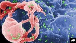 Scanning electron micrograph of HIV-1, colored green, budding from a cultured lymphocyte.