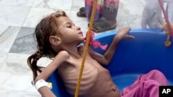 FILE - In this Aug. 25, 2018 file image made from video, a severely malnourished girl is weighed at the Aslam Health Center in Hajjah, Yemen. The U.N. food agency said Wednesday, Sept. 19, 2018, that time is running out for aid groups operating in Yemen t