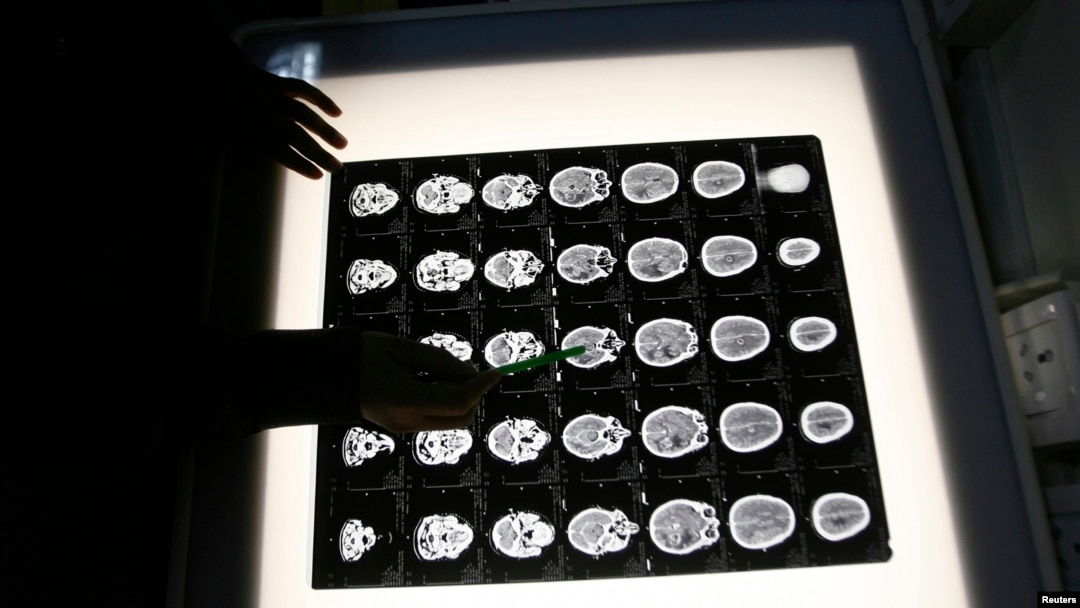 Seorang ahli radiologi memeriksa hasil rontgen seorang pasien. (Foto:dok)