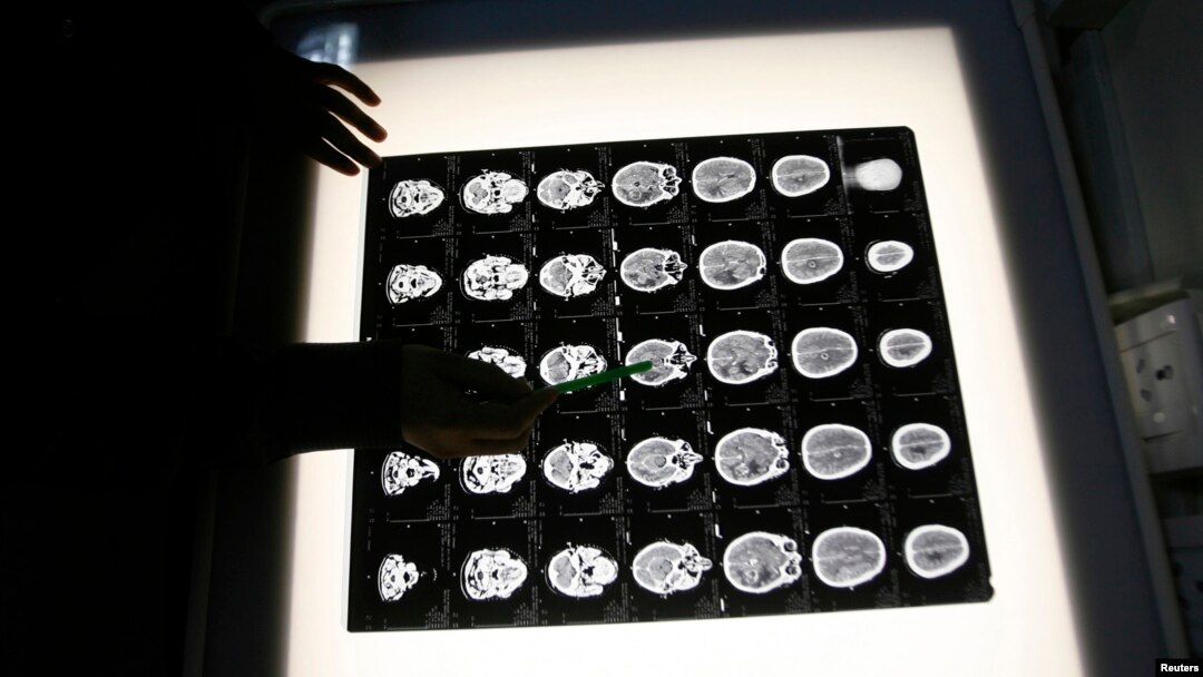 Seorang radiolog memeriksa hasil x-ray otak pasien di rumah sakit onkologi North Bengal, Siliguri, India.